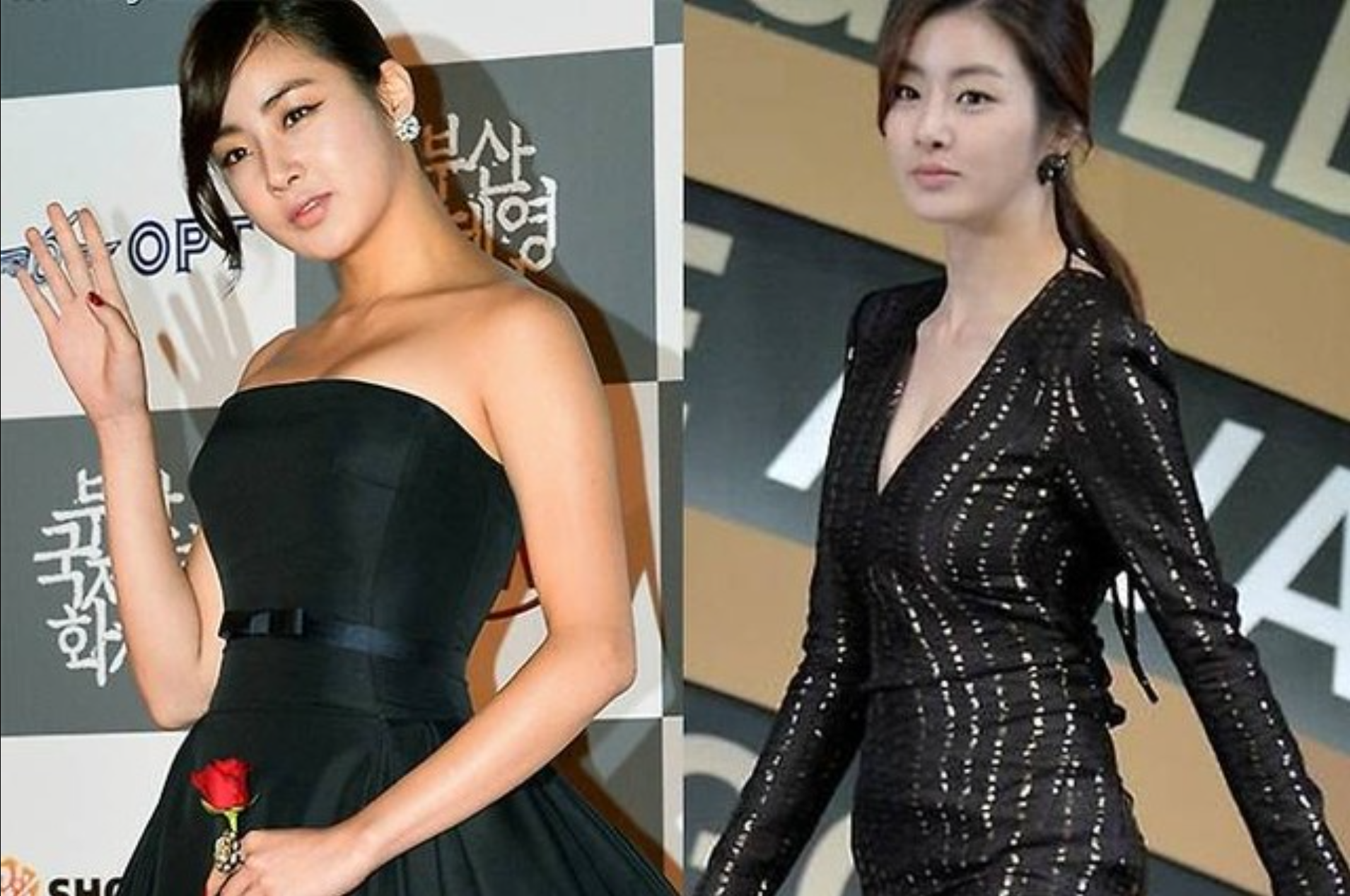 자세 교정으로 실루엣이 좋아진 대표적인 케이스
